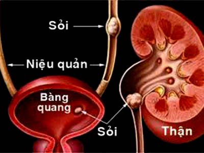 /images/post/2014/12/30/14//soinieuquan.jpg